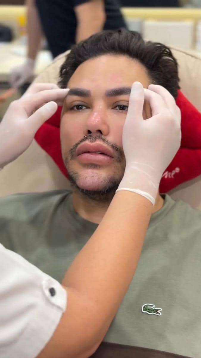 potret Ivan Gunawan jalani treatment tarik benang (instagram.com/ivan_gunawan)