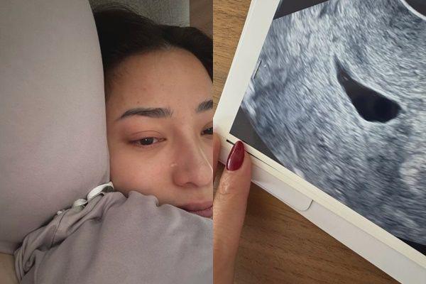 Kronologi Nikita Willy Keguguran saat Hamil Anak Kedua, Baru 7 Minggu