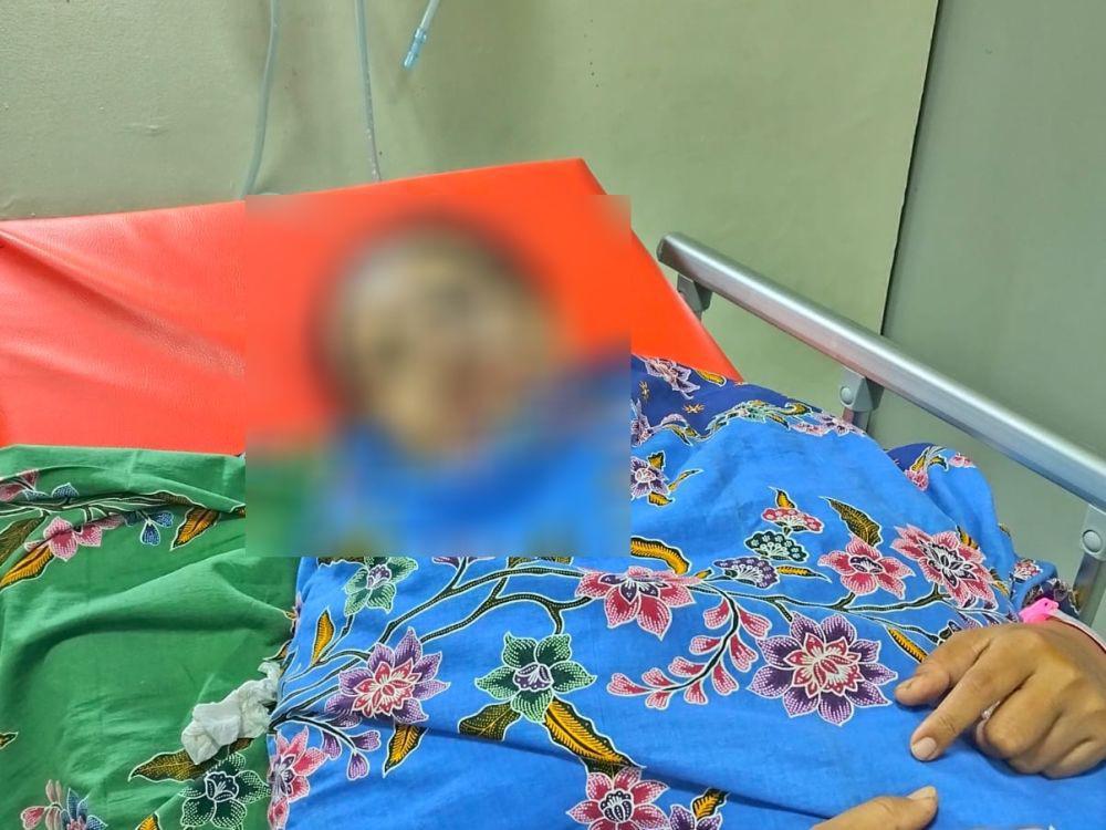 Ditolak Rujuk, Pria di Makassar Sirami Mantan Istri Air Keras