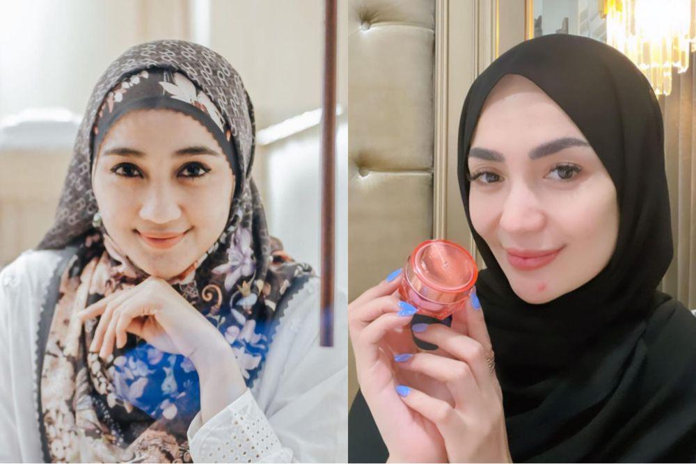 Sering Dibilang Mirip, 8 Fakta Imel dan Penty Gentabuana Sekarang