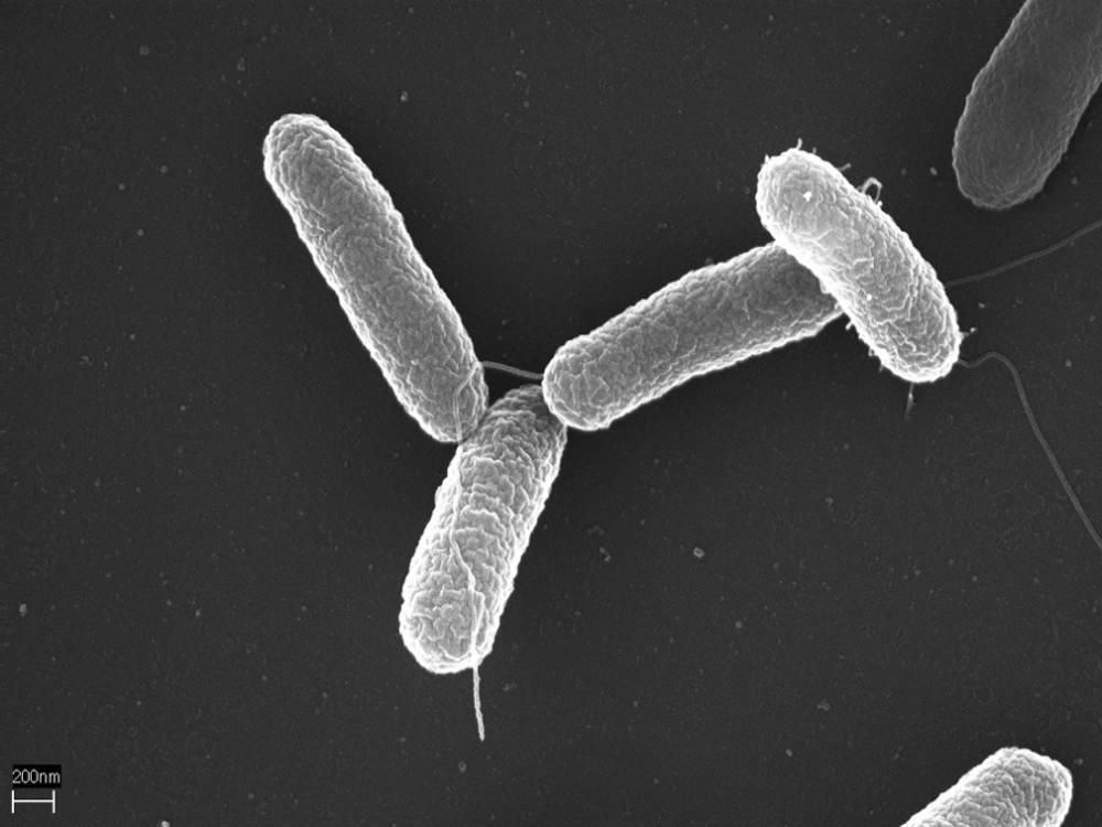 ilustrasi bakteri Salmonella (en.wikipedia.org/Volker Brinkmann)