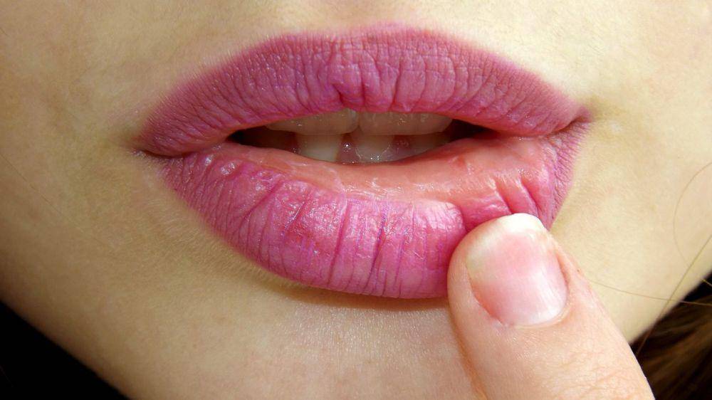 Ilustrasi bibir kering (pixabay.com)
