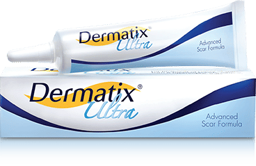 produk Dermatix Ultra Gel (dermatix.co.id)