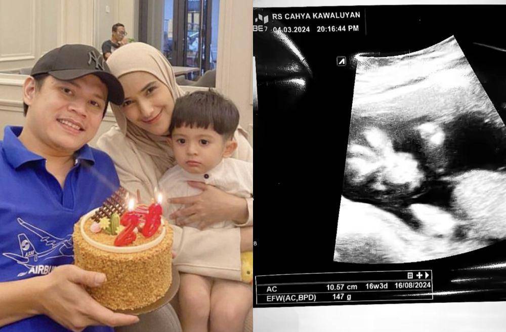 7 Potret Bahagia Nadya Mustika dan Suami, Umumkan Hamil Anak Kedua