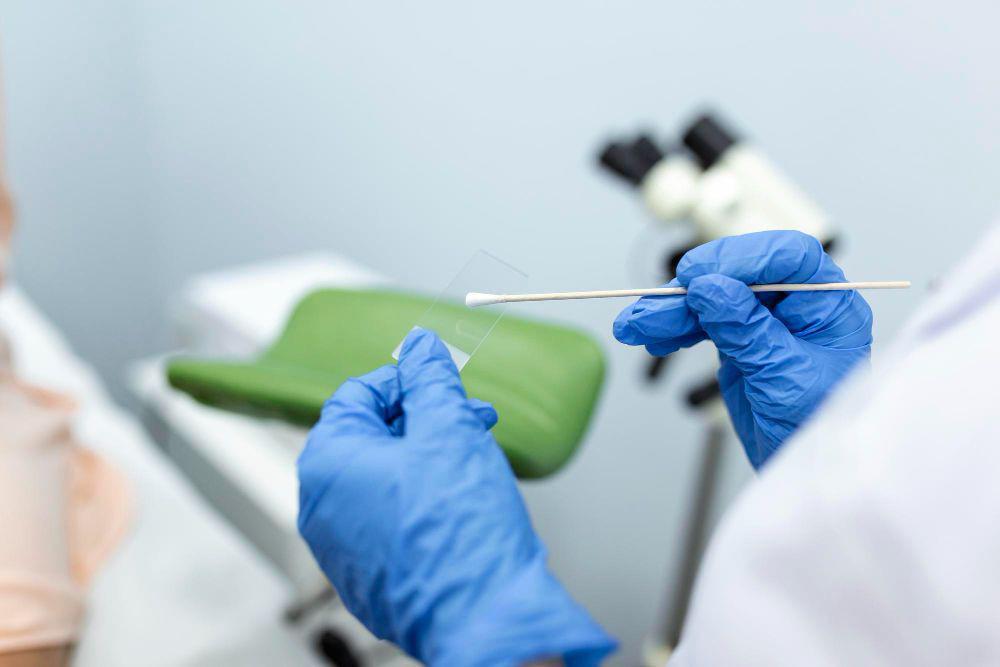 Alasan Pentingnya Pap Smear Rutin bagi Perempuan