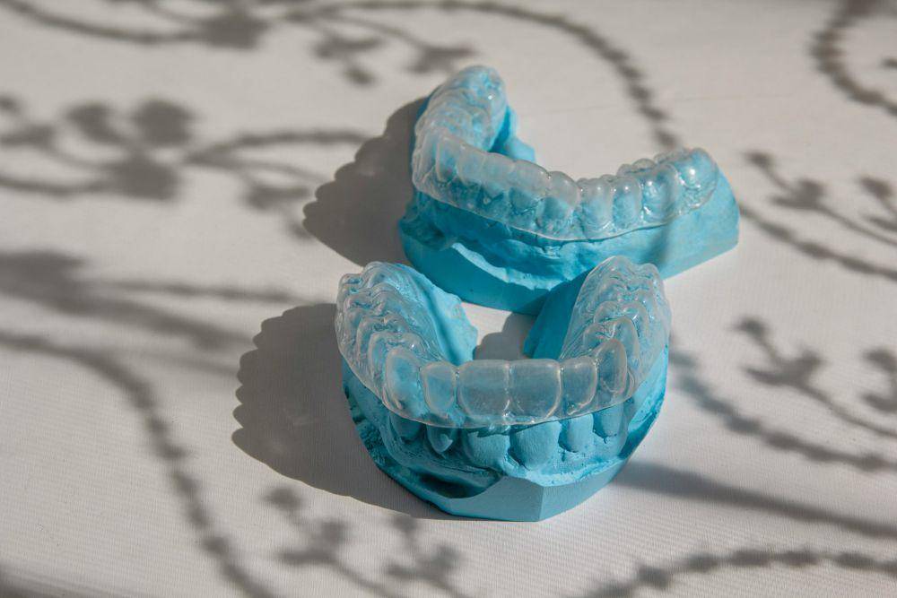 Ilustrasi invisalign (unsplash.com/Ozkan Guner)