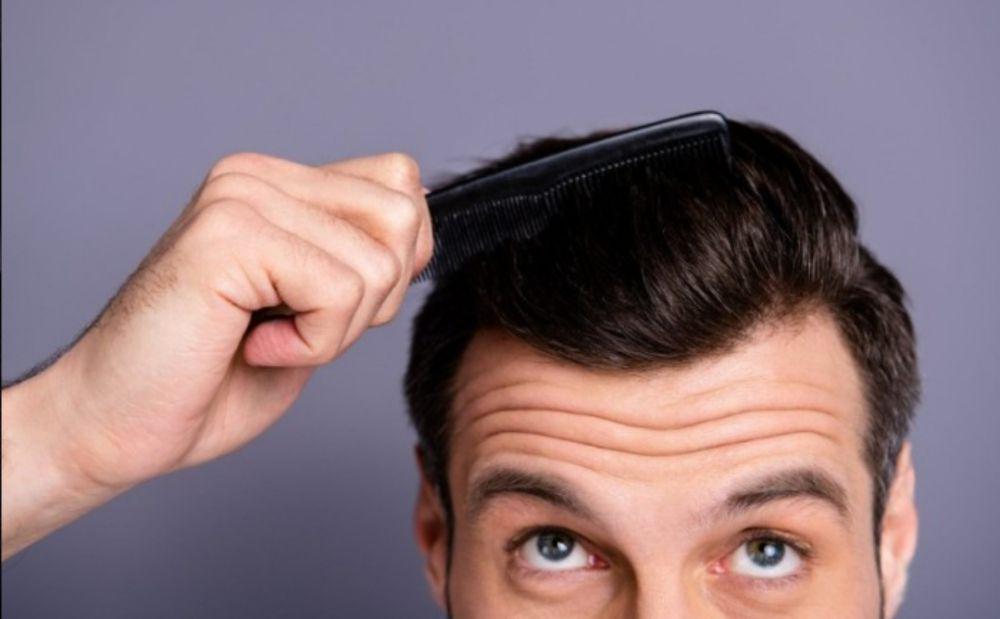 4 Rekomendasi Vitamin Rambut Pria, Bikin Sehat dan Tebal!
