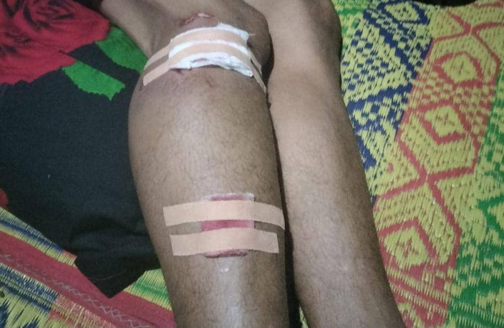 Luka akibat cakaran dan gigitan beruang (Dok: istimewa)