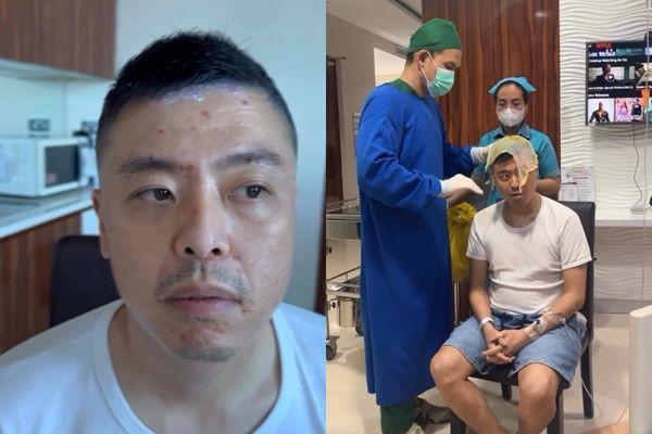 7 Potret Vincent Raditya Idap Flu Singapura, Merasa Tersiksa