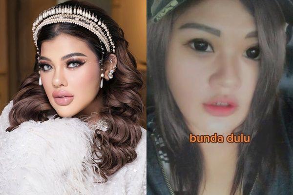 7 Potret Lawas Shindy Samuel, Berat Badan Naik Drastis Saat Hamil