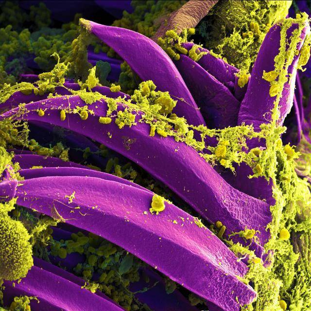 ilustrasi bakteri Yersinia pestis, bakteri penyebab pes (flickr.com/NIAID)