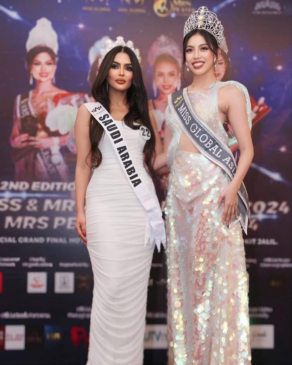 Potret Miss Universe Arab Saudi 2024 Rumy Alqahtani (Instagram.com/rumy_alqahtani)