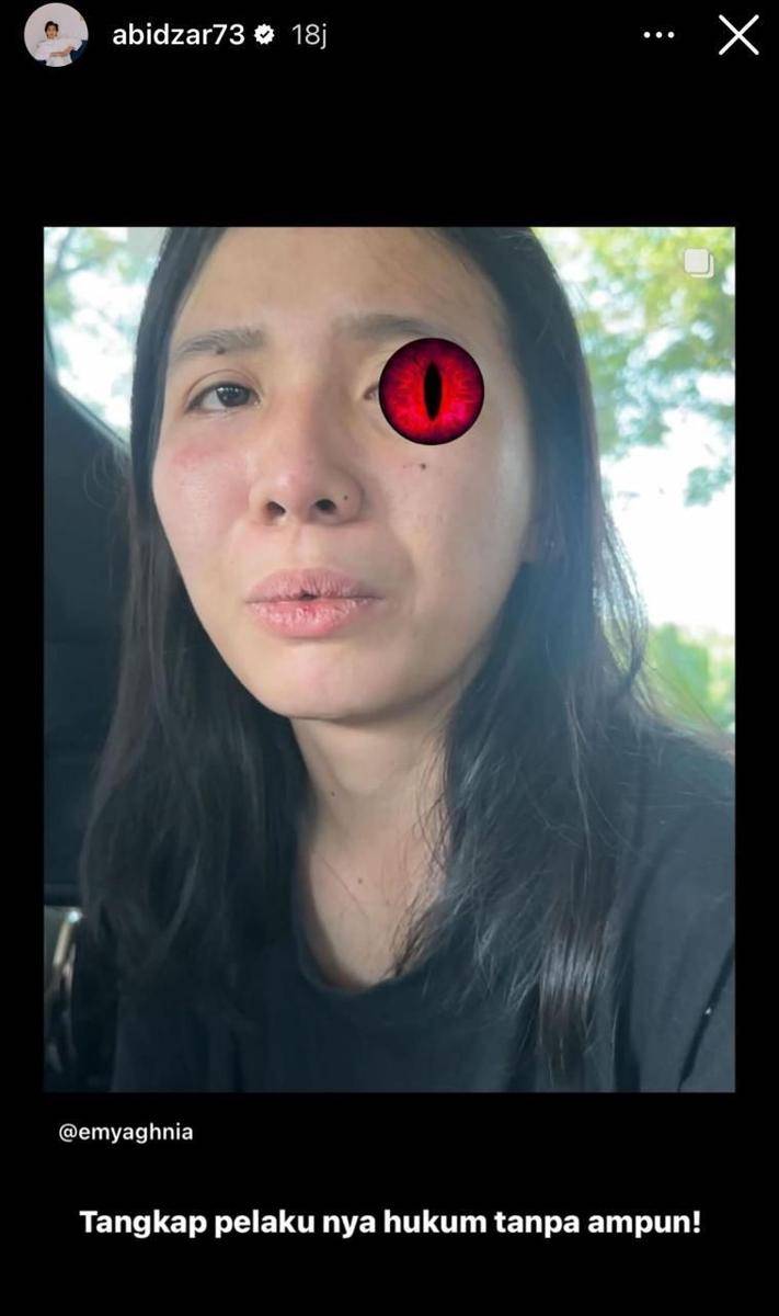 Artis dukung Aghnia Punjabi (instagram.com/Abidzar73)