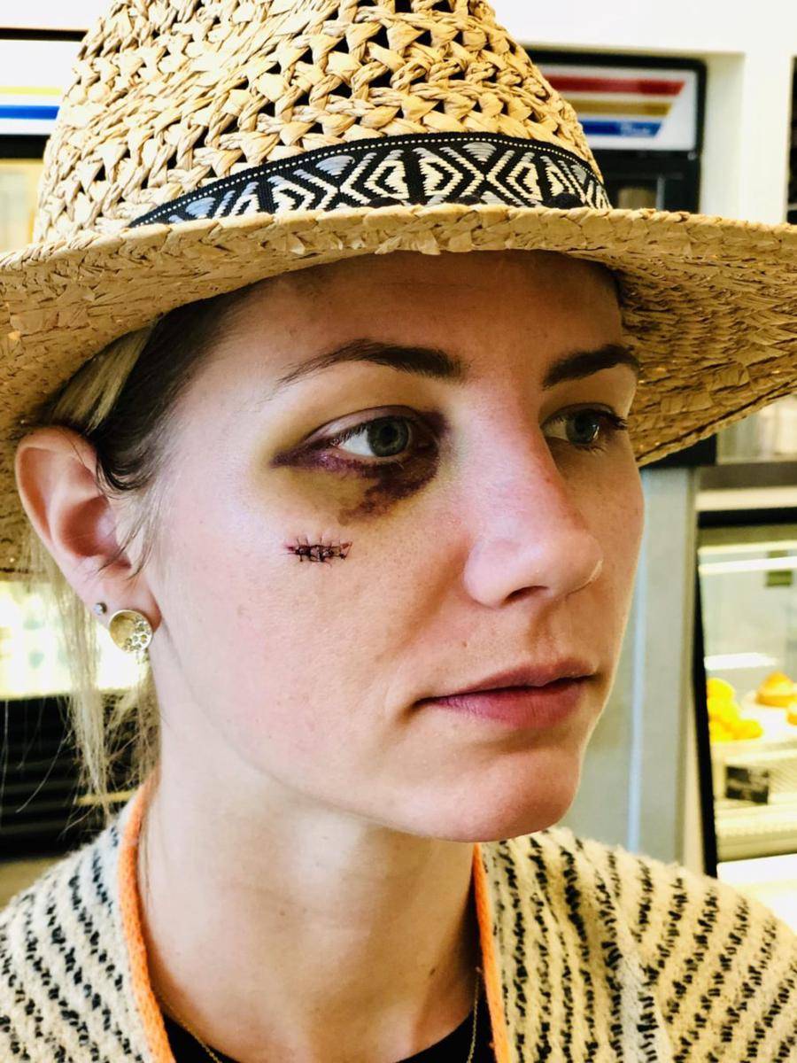potret momen apes karena golf (reddit.com/user/meatloaf18)