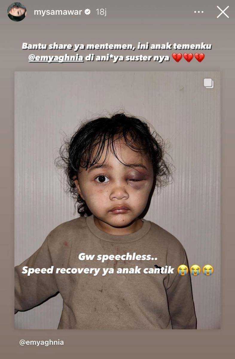 Artis dukung Aghnia Punjabi (instagram.com/Mysamawar)