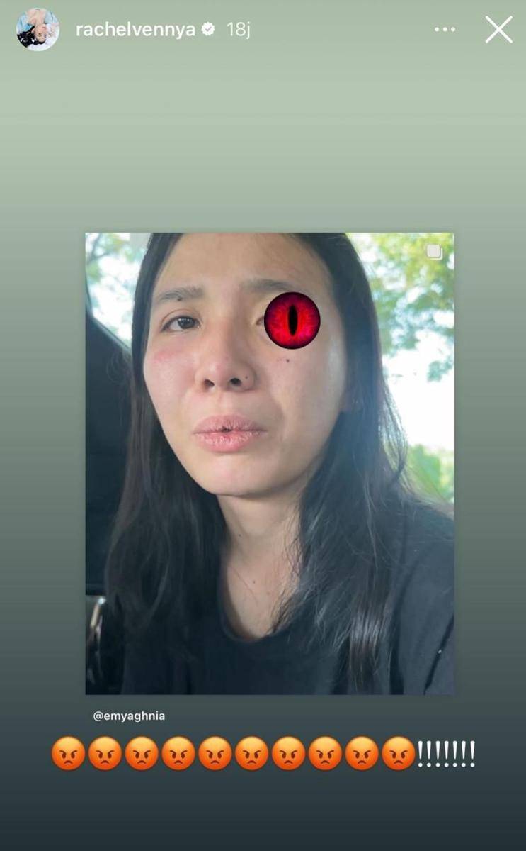 Artis dukung Aghnia Punjabi (instagram.com/rachelvennya)