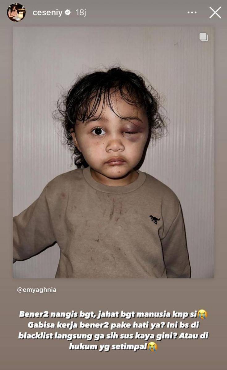 Artis dukung Aghnia Punjabi (instagram.com/Ceseniy)
