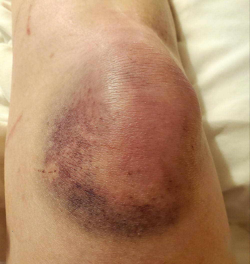 potret momen apes soal tenis meja (reddit.com/user/Cronchy_Tacos)