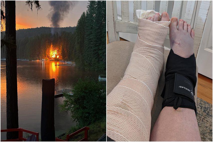 7 Momen Apes Hari Pertama Liburan, Kaki sampai Patah!