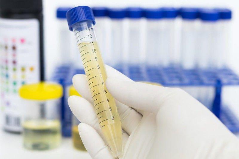 Tes Urine Kasat Narkoba Polres Blitar Positif Narkoba
