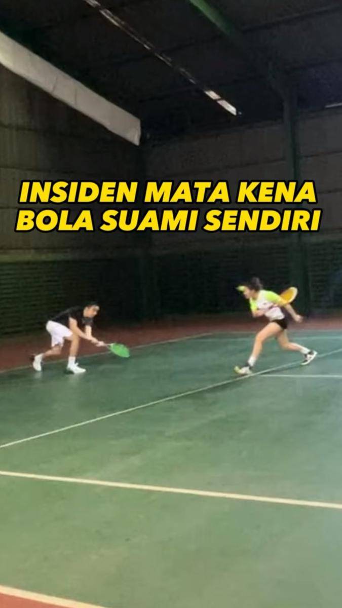 potret mata Ayu Dewi terkena pantulan bola tenis suaminya (instagram.com/mrsayudewi)