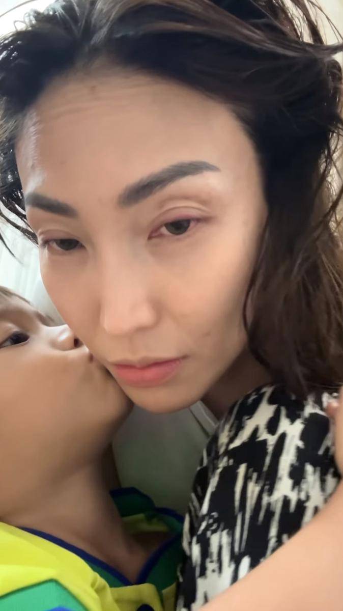 potret mata Ayu Dewi terkena pantulan bola tenis suaminya (instagram.com/mrsayudewi)