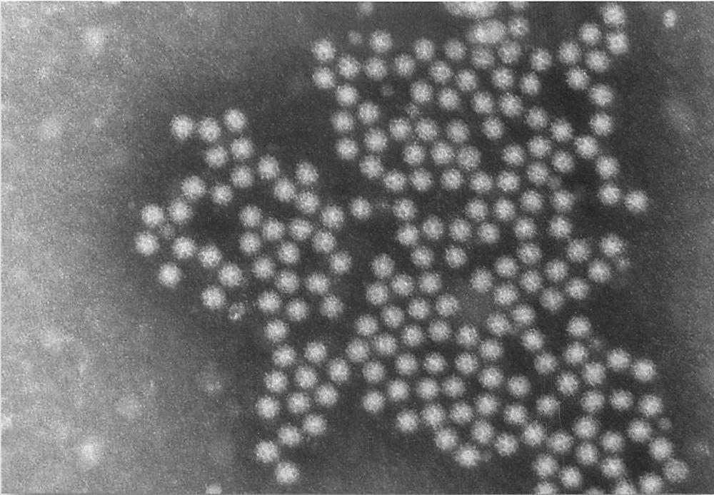 Infeksi Sapovirus, Apakah Berbahaya?