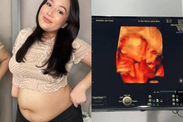 potret Sandra Lubis umumkan kehamilan (instagram.com/sandralubis)