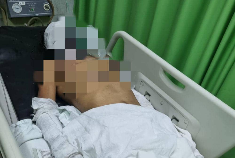 Kabar Duka, 1 Korban Kecelakaan Kerja di PT San Xiong Steel Meninggal