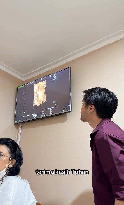 potret Kevin Aprilio umumkan kehamilan istri (instagram.com/kevinaprilio)