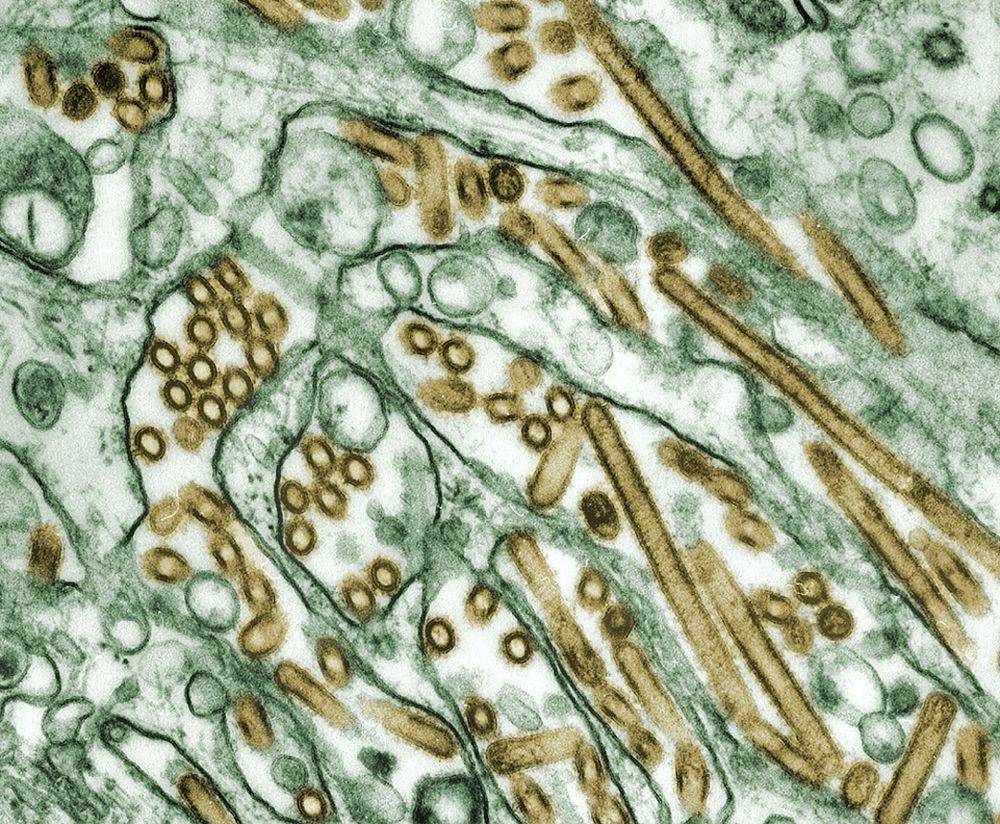 ilustrasi virus (unsplash.com/CDC)