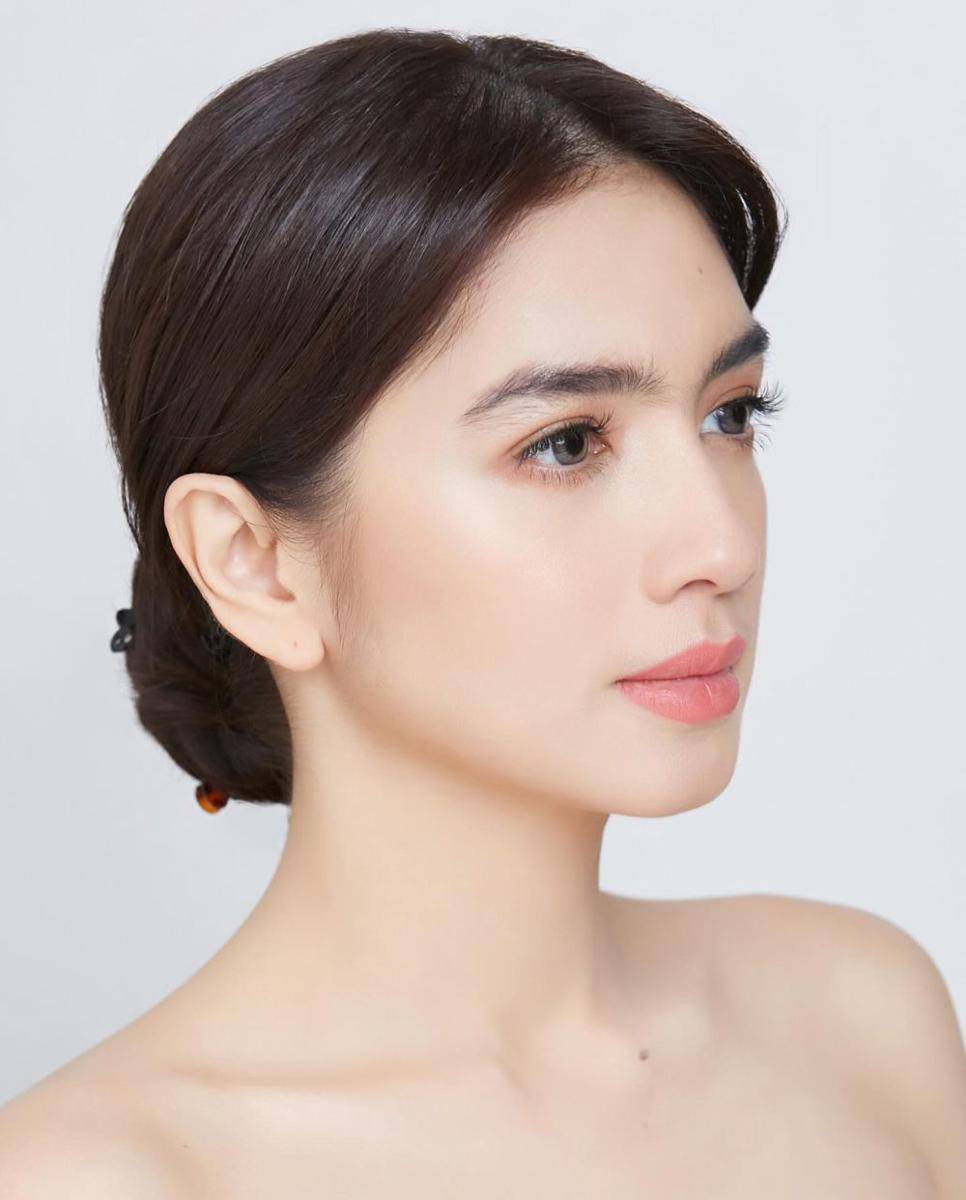 potret Angel Karamoy usai oplas (instagram.com/realangelkaramoy)