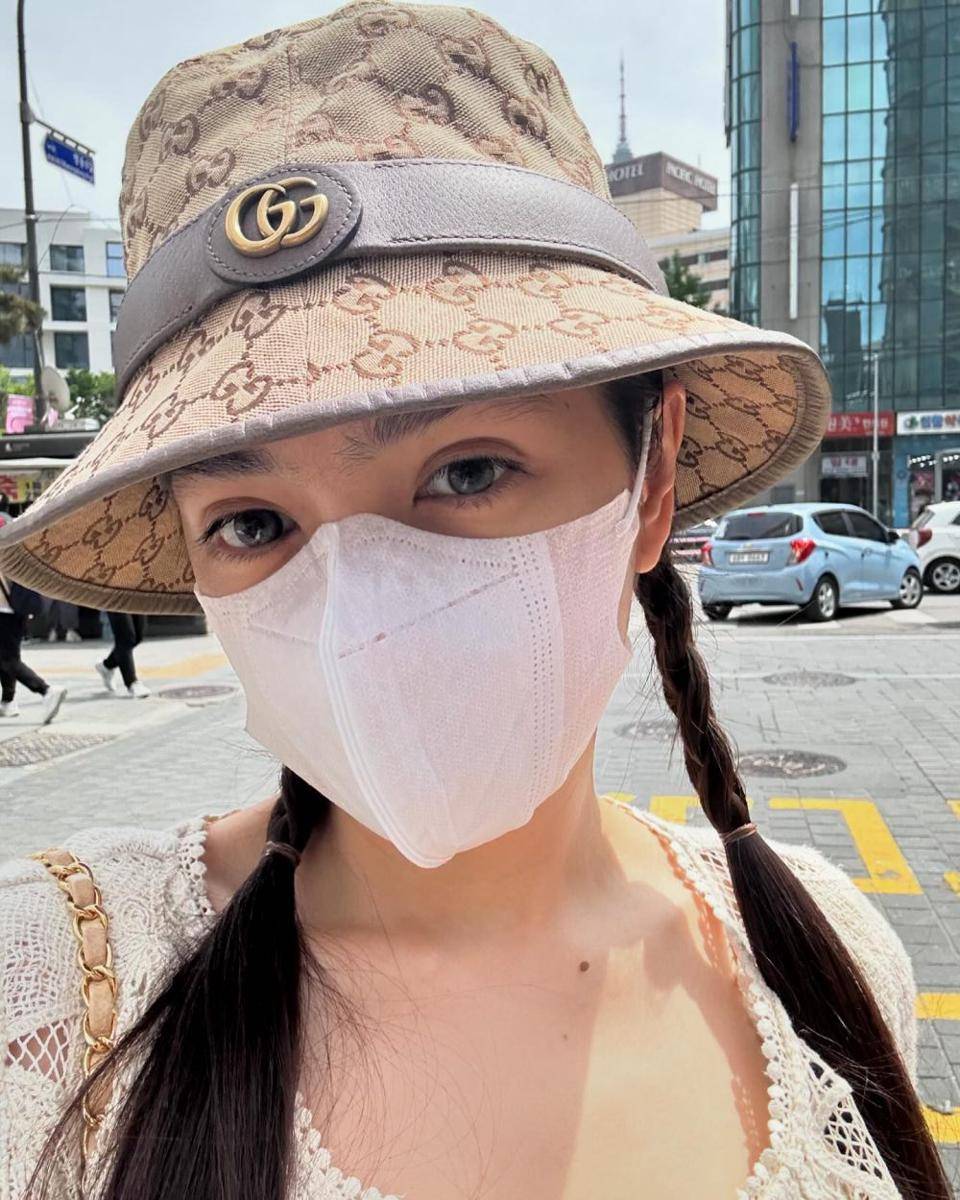 potret Angel Karamoy usai oplas (instagram.com/realangelkaramoy)