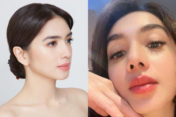 Baru Di-Publish, 7 Potret Wajah Angel Karamoy Usai Oplas di Korea
