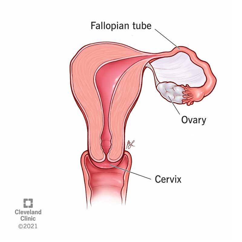 Rahim unicornuate (clevelandclinic.org)