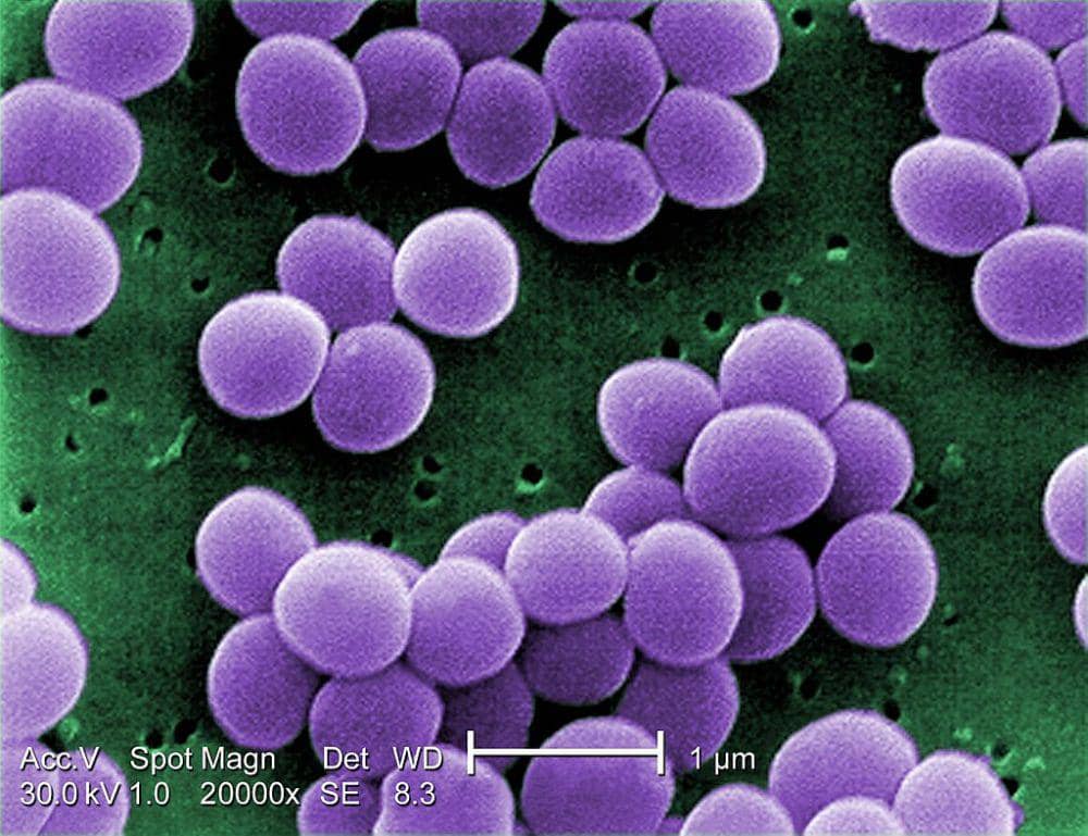 Mengenal Staphylococcus aureus, Bakteri Penyebab Keracunan Makanan