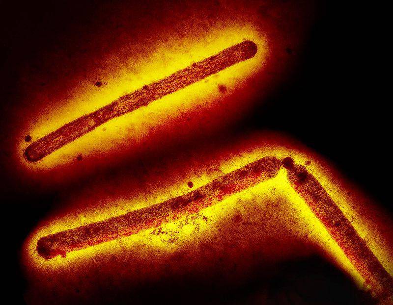 Partikel virus influenza A (H5N1/flu burung) (berbentuk batang). (flickr.com/NIAID)