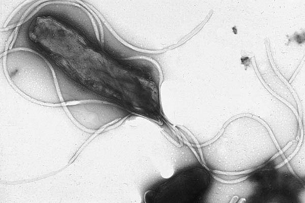 Penampakan bakteri Helicobacter pylori pada mikroskop elektron. (commons.wikimedia.org/Yutaka Tsutsumi)