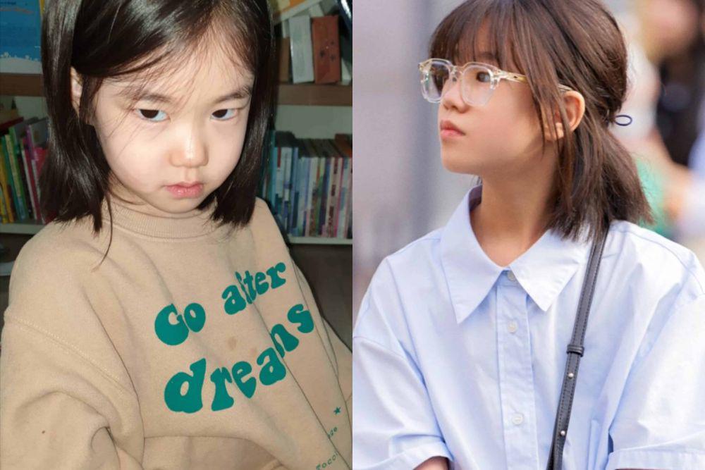 8 Transformasi Park So Yi The Atypical Family yang Disorot Netizen