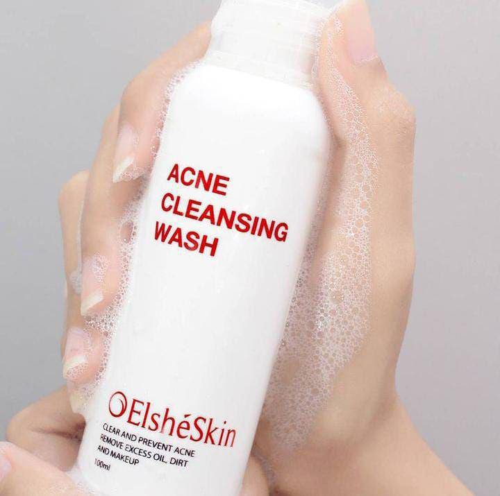 ilustrasi elshe skin acne cleansing (instagram.com/ elsheskin)