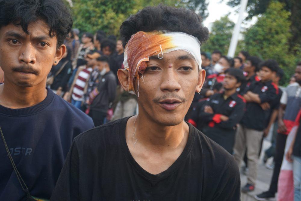 Demo Tapera di DPRD DIY Ricuh, Peserta Aksi Alami Bocor Pelipis