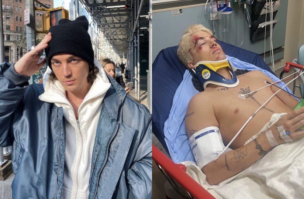 Paul LANY Ditabrak Mobil saat Kendarai Vespa, Begini Kabar Terkininya
