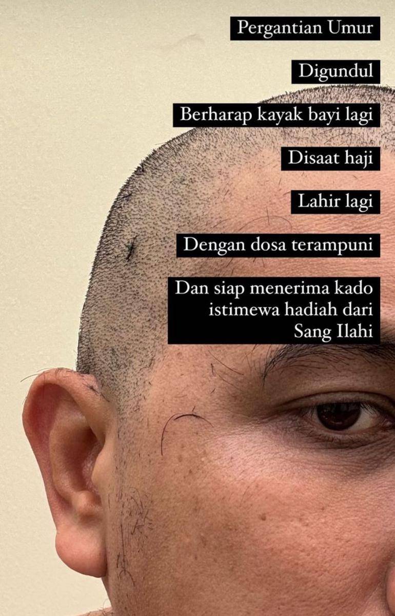 potret artis tampil botak usai jalani tahallul haji 2024 (Instagram.com/ardanaff)