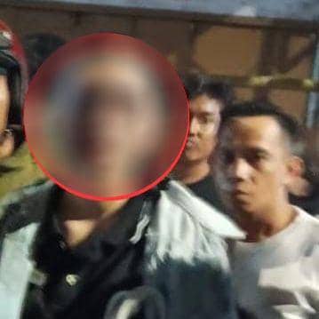 Kondisi korban penjambretan. (Dok. Polrestabes Makassar)
