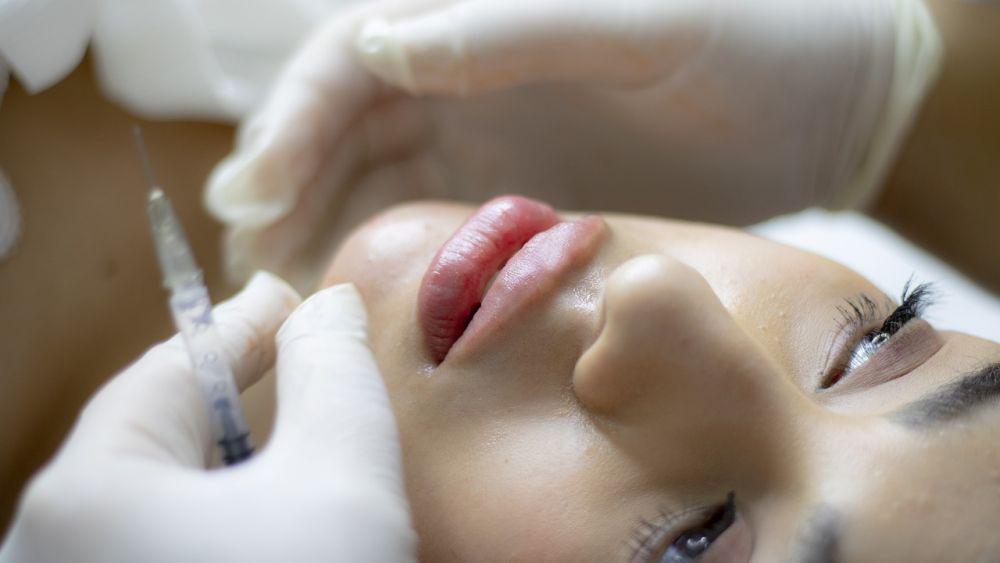 Mengenal 5 Jenis Filler untuk Perawatan Kecantikan