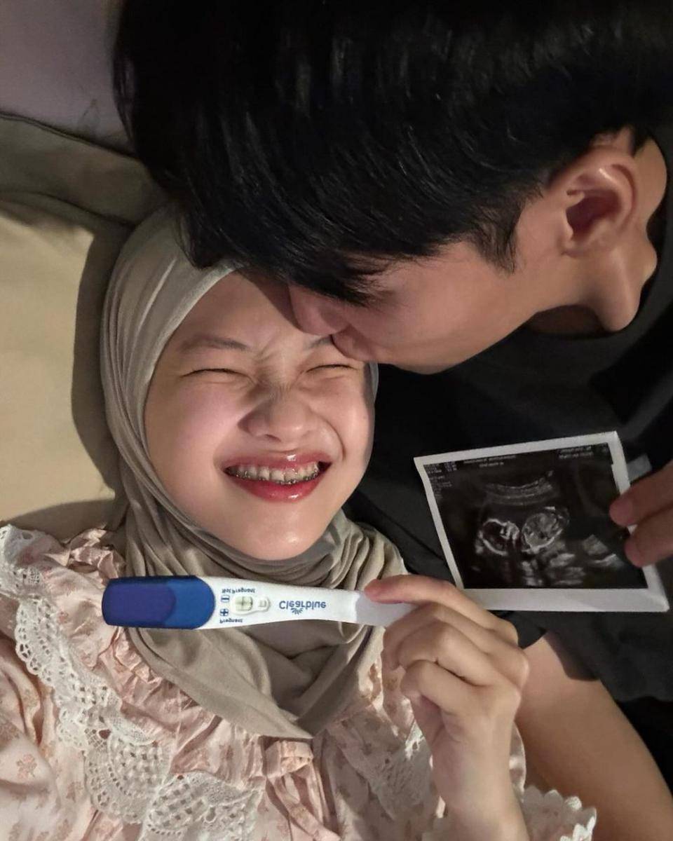 potret Julia Prastini (instagram.com/juliaprt7)