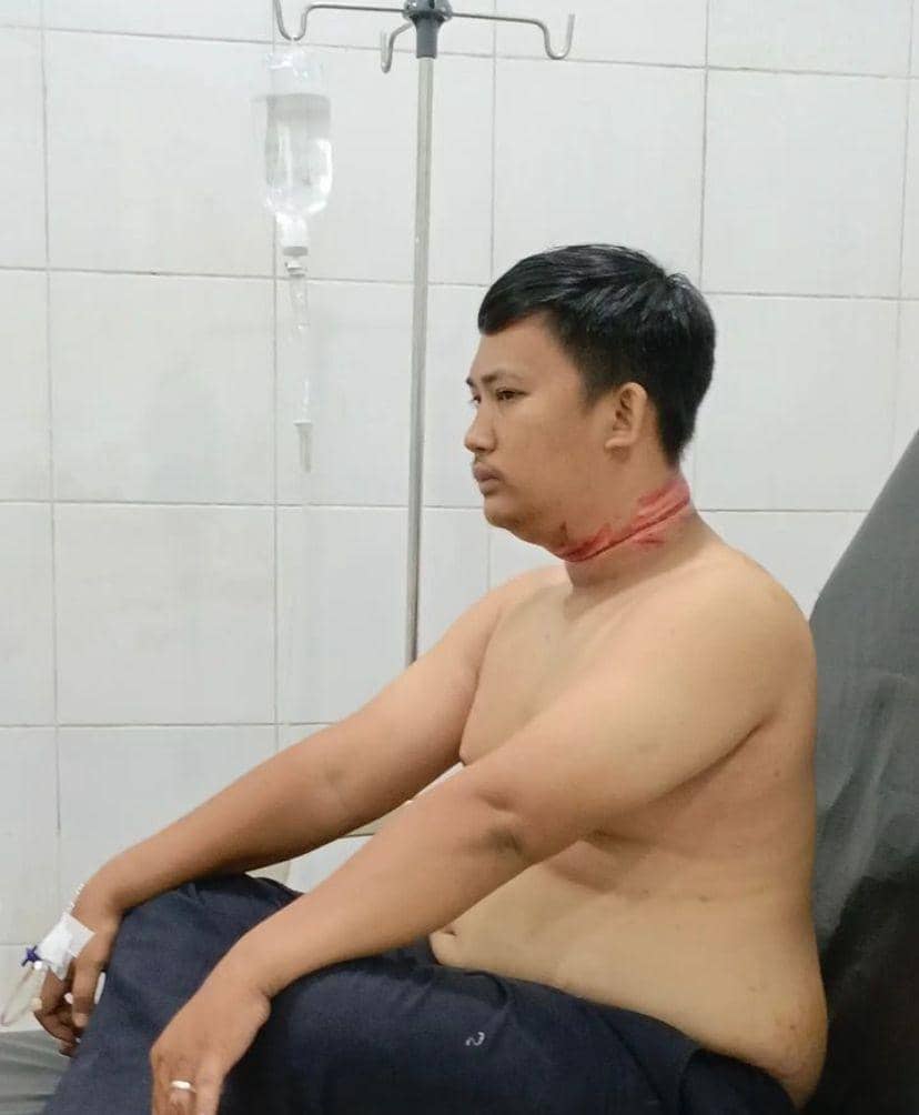 Aktivis Lingkungan Korban Kabel Semrawut Bikin Laporan ke Polda Sumut