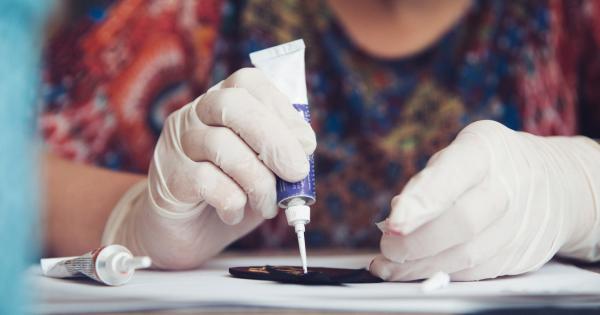 7 Cara Mengelupas Superglue dari Kulit, Lakukan dengan Lembut