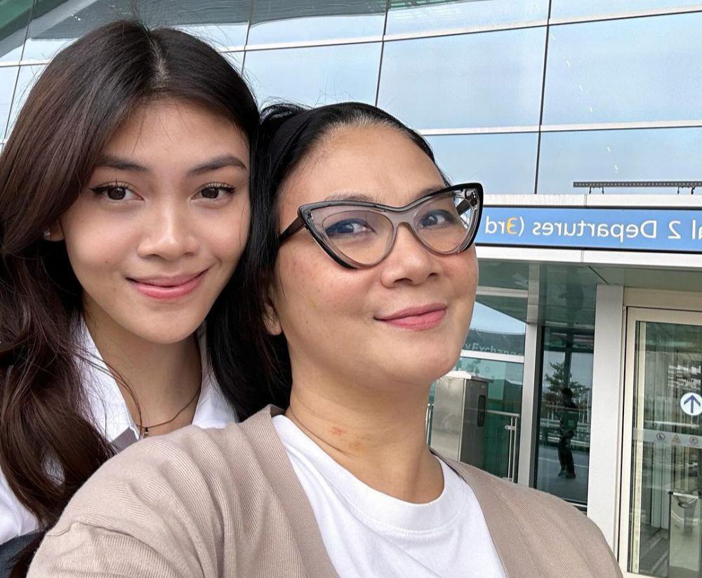 7 Potret Dian Nitami setelah Operasi Plastik, Makin Percaya Diri!