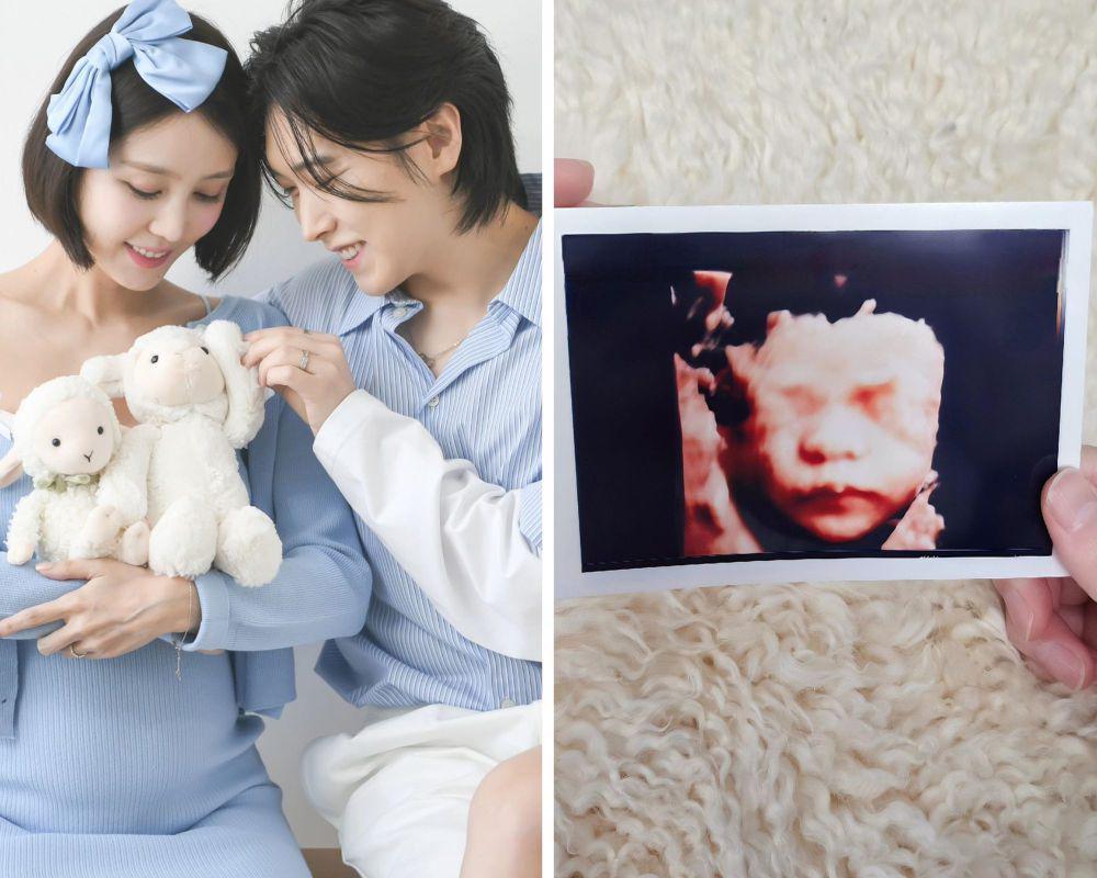 Cerita Sungmin Super Junior tentang Penantian Anak Pertamanya